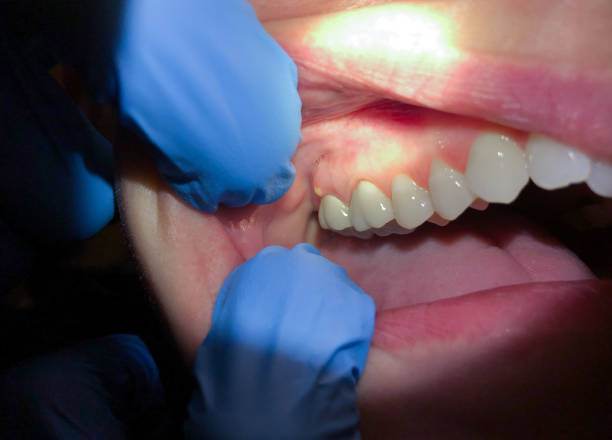 Best Emergency Dental Services Near Me  in Mangonia Park, FL