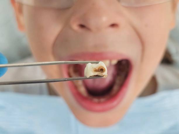 Best Emergency Tooth Extraction  in Mangonia Park, FL